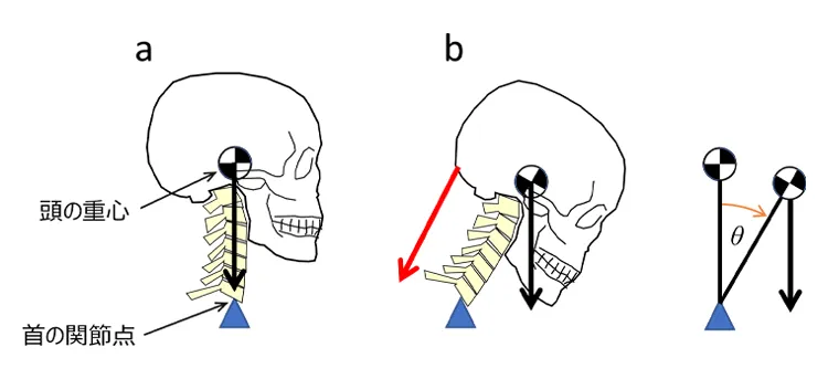 【身体構造力シリーズ】 第5回：頭痛