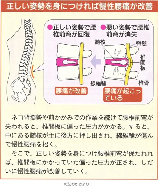 【身体構造力シリーズ】 第7回：椎間板ヘルニア