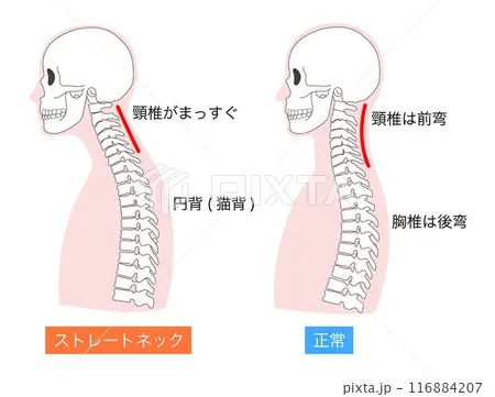 【構造深掘り解説】「整体　頭痛」でお探しの方へ